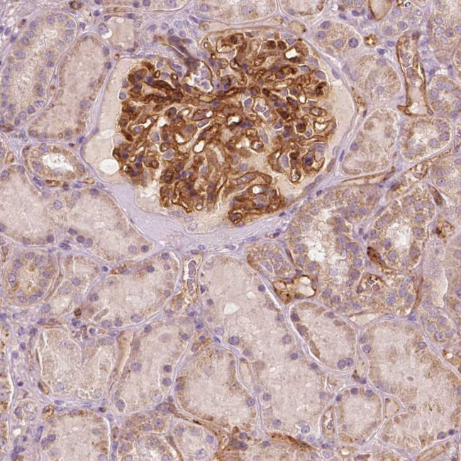 TSPO2 Antibody in Immunohistochemistry (Paraffin) (IHC (P))