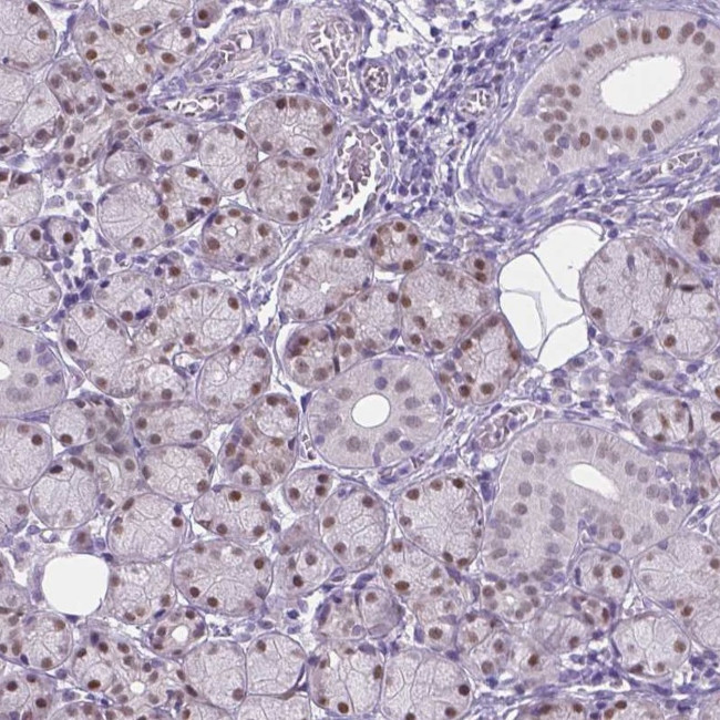 APCDD1L Antibody in Immunohistochemistry (Paraffin) (IHC (P))