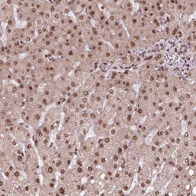 SNRNP35 Antibody in Immunohistochemistry (Paraffin) (IHC (P))