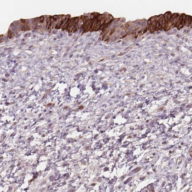 TMEM80 Antibody in Immunohistochemistry (Paraffin) (IHC (P))