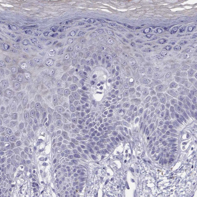 UMODL1 Antibody in Immunohistochemistry (Paraffin) (IHC (P))