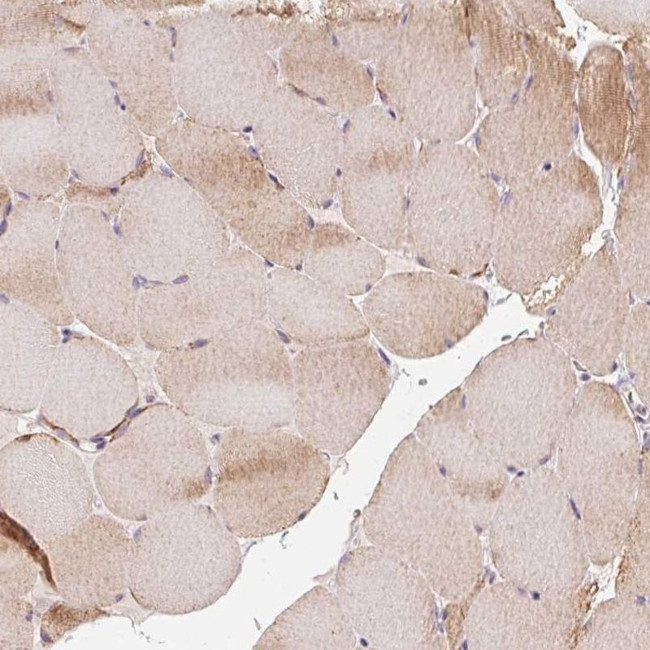 COQ7 Antibody in Immunohistochemistry (IHC)