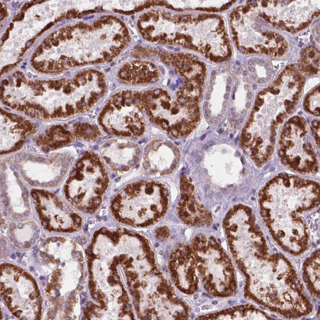 C18orf21 Antibody in Immunohistochemistry (Paraffin) (IHC (P))