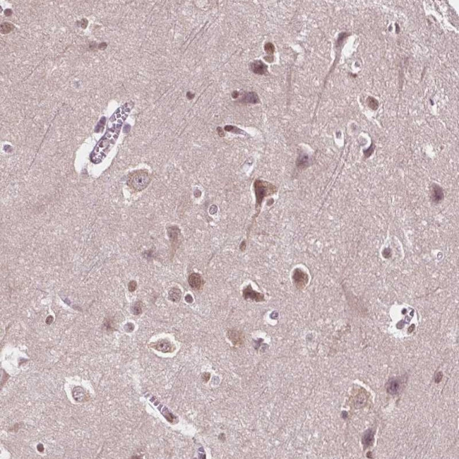 ISLR2 Antibody in Immunohistochemistry (Paraffin) (IHC (P))