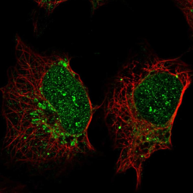 SP140 Antibody in Immunocytochemistry (ICC/IF)
