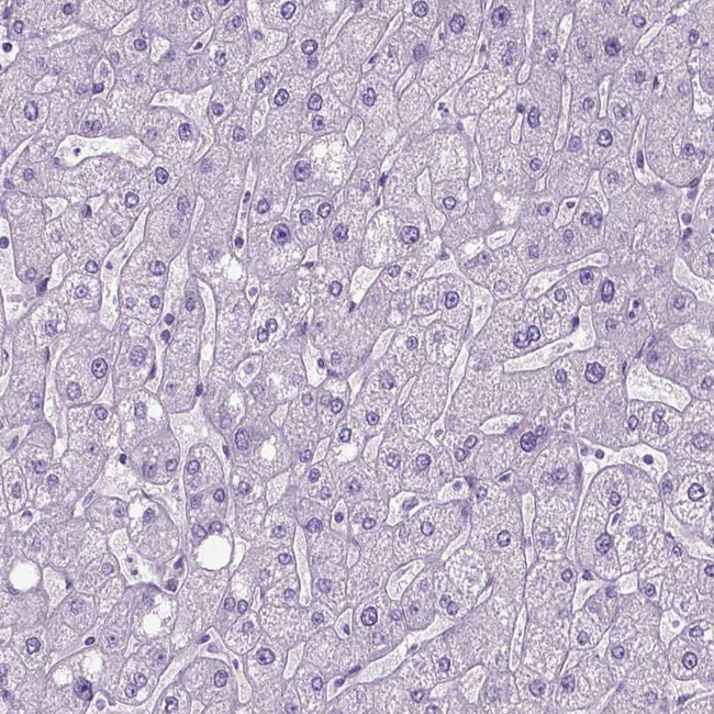GABRB2 Antibody in Immunohistochemistry (Paraffin) (IHC (P))