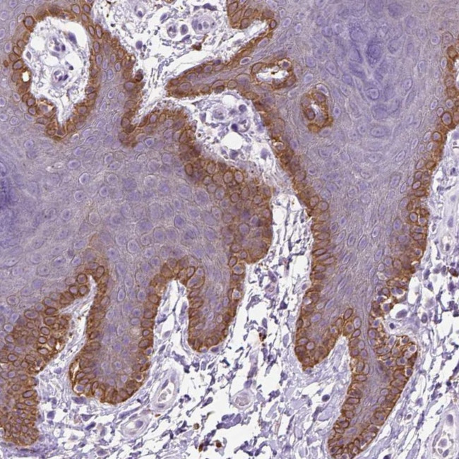 NUDT2 Antibody in Immunohistochemistry (Paraffin) (IHC (P))