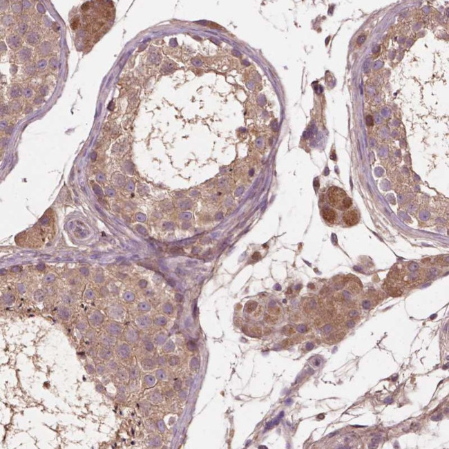 GJA9 Antibody in Immunohistochemistry (Paraffin) (IHC (P))