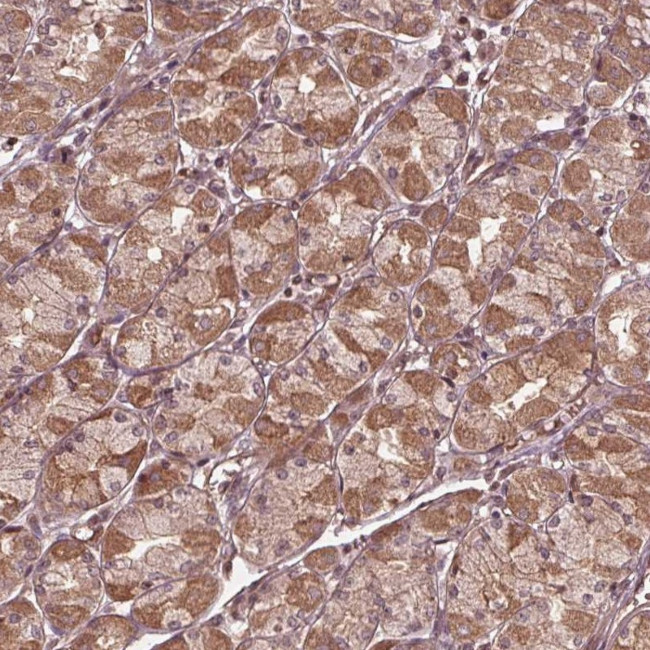 CDKL4 Antibody in Immunohistochemistry (Paraffin) (IHC (P))