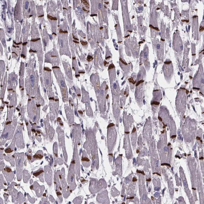 RD3L Antibody in Immunohistochemistry (Paraffin) (IHC (P))