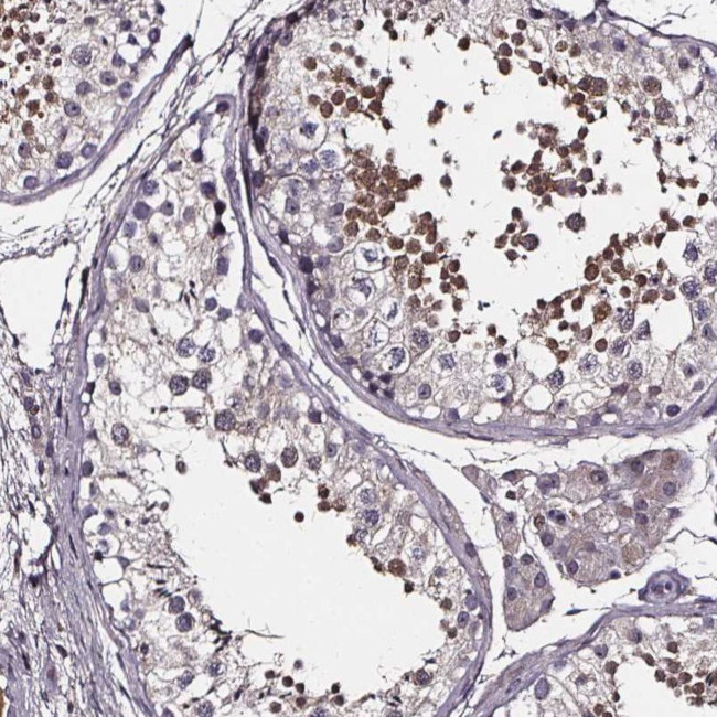 SPAG8 Antibody in Immunohistochemistry (Paraffin) (IHC (P))
