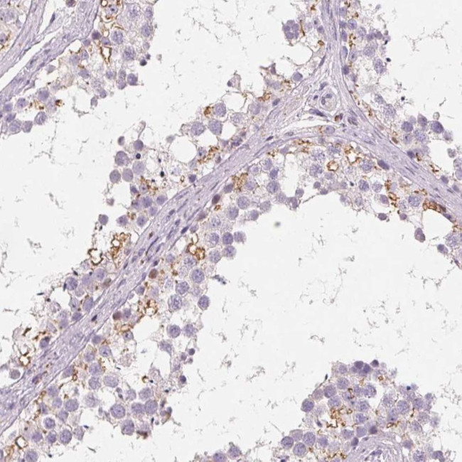 C19orf84 Antibody in Immunohistochemistry (Paraffin) (IHC (P))