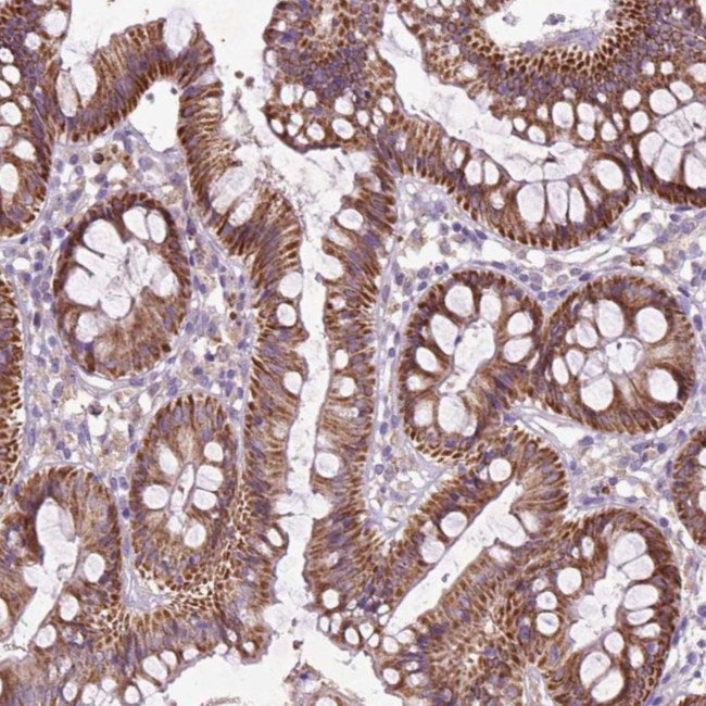 THEGL Antibody in Immunohistochemistry (Paraffin) (IHC (P))