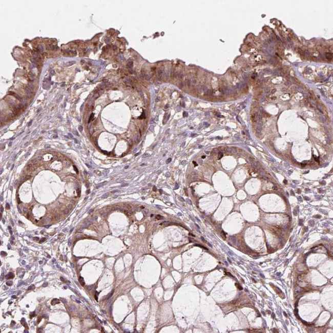 FNIP1 Antibody in Immunohistochemistry (Paraffin) (IHC (P))