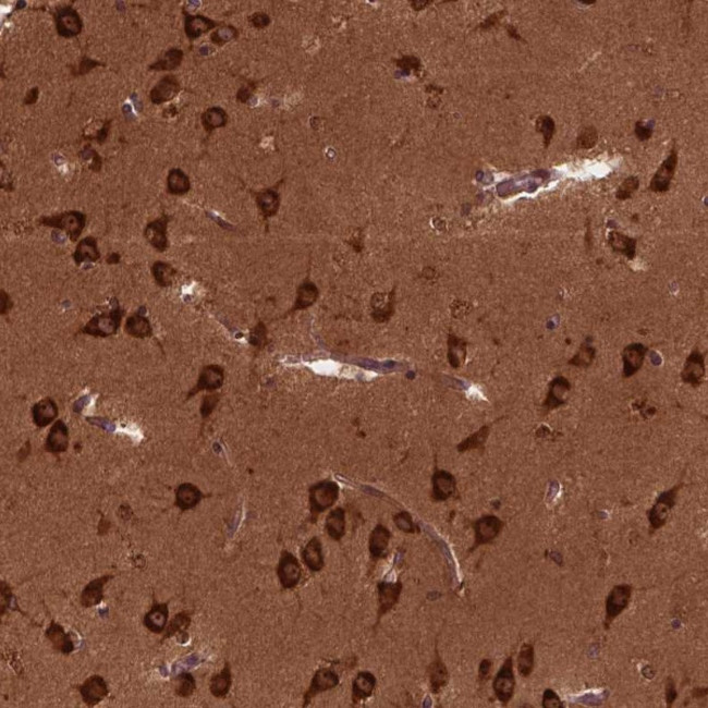 CYFIP1 Antibody in Immunohistochemistry (Paraffin) (IHC (P))