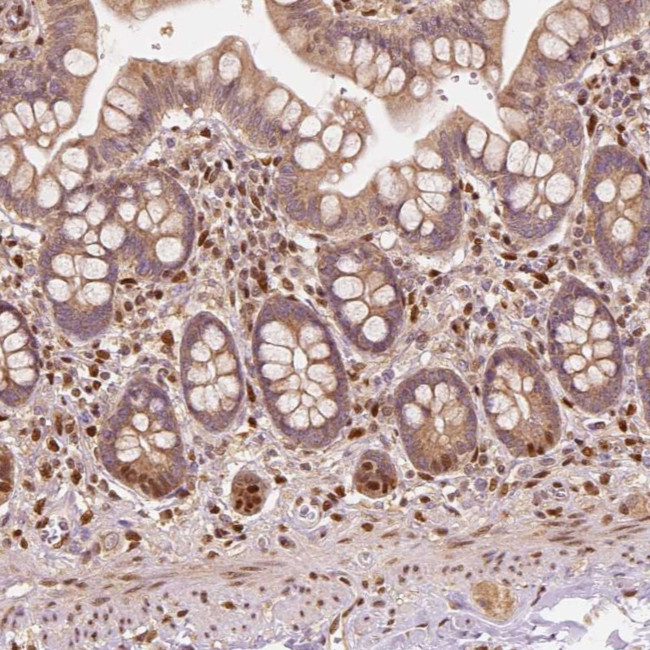 TBC1D17 Antibody in Immunohistochemistry (Paraffin) (IHC (P))