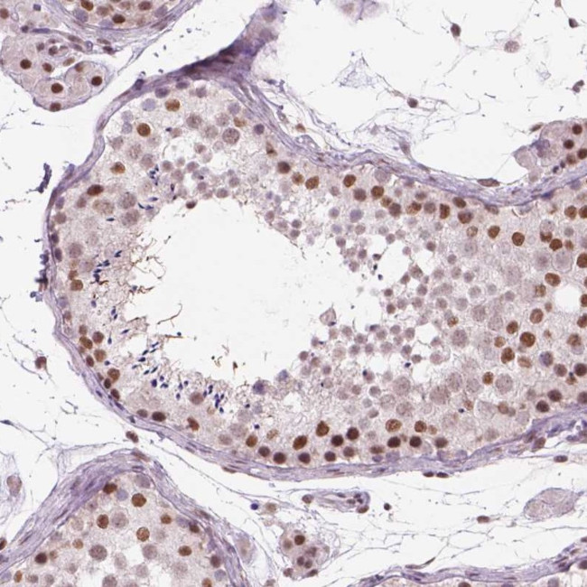 POLR3D Antibody in Immunohistochemistry (Paraffin) (IHC (P))