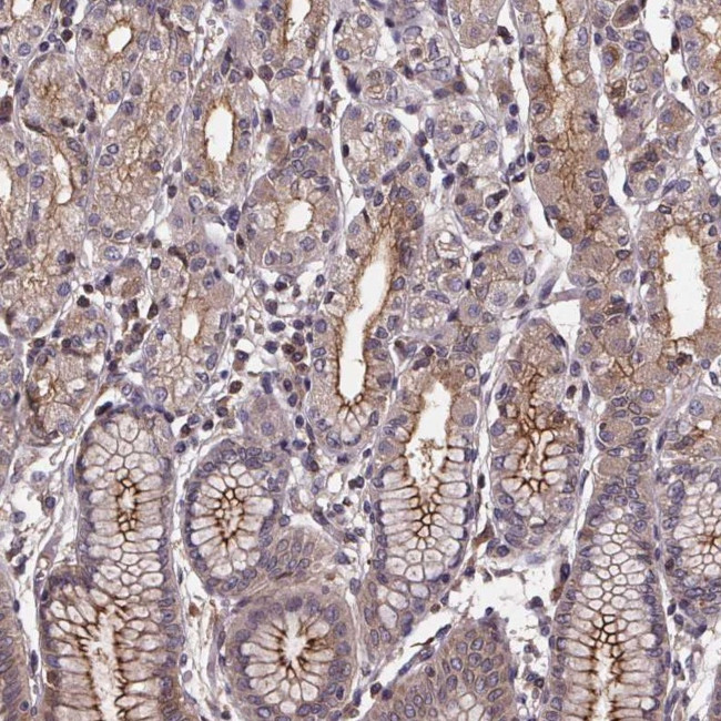FASTKD3 Antibody in Immunohistochemistry (Paraffin) (IHC (P))