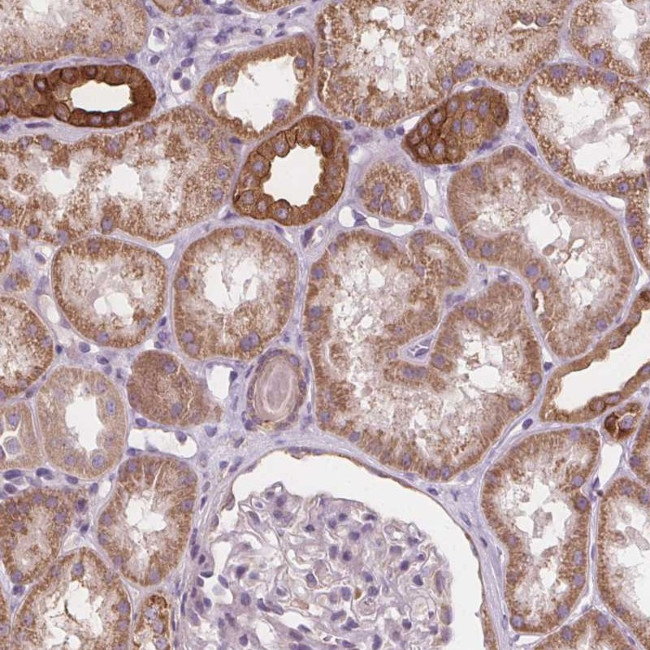 RAB20 Antibody in Immunohistochemistry (Paraffin) (IHC (P))
