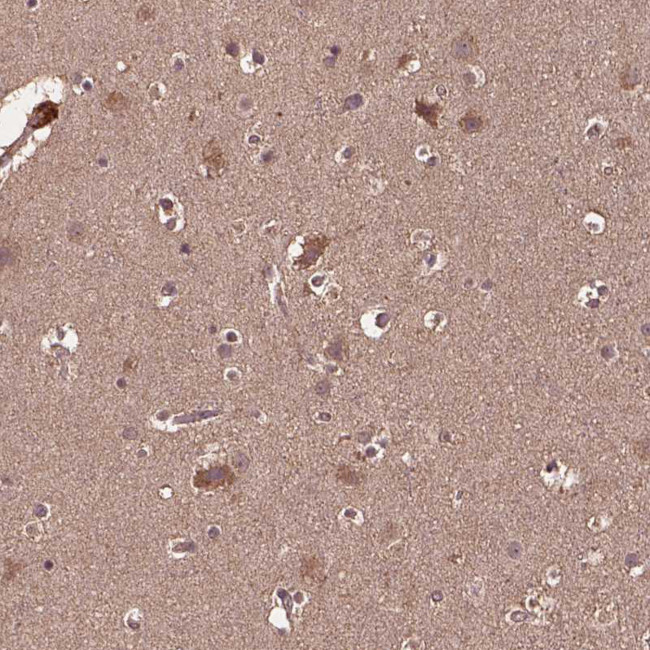 BABAM1 Antibody in Immunohistochemistry (Paraffin) (IHC (P))