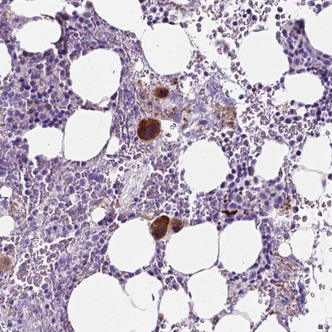 EBLN2 Antibody in Immunohistochemistry (Paraffin) (IHC (P))
