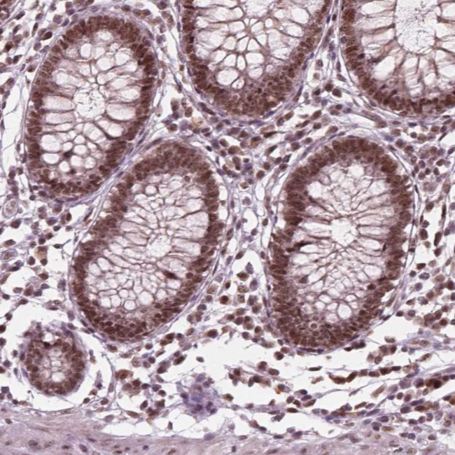 POLR2E Antibody in Immunohistochemistry (Paraffin) (IHC (P))