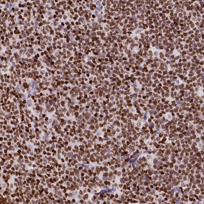 CBY3 Antibody in Immunohistochemistry (Paraffin) (IHC (P))