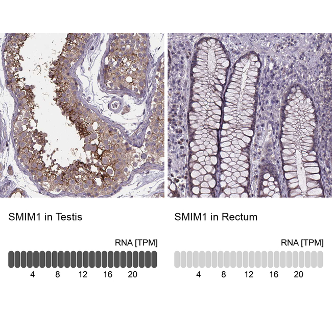SMIM1 Antibody in Immunohistochemistry (Paraffin) (IHC (P))