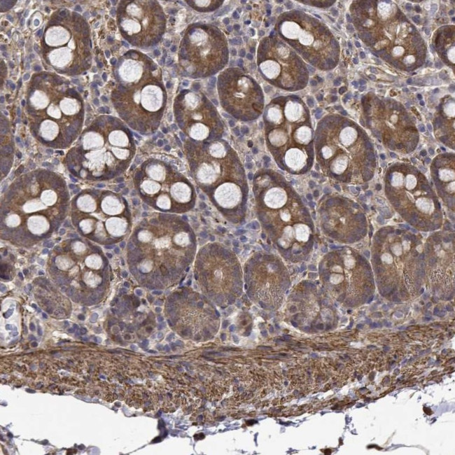 PCID2 Antibody in Immunohistochemistry (Paraffin) (IHC (P))
