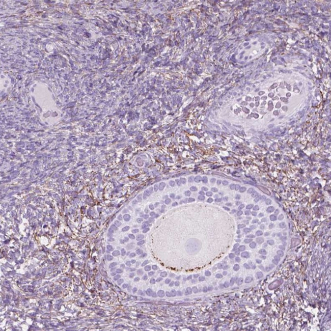 GDF9 Antibody in Immunohistochemistry (Paraffin) (IHC (P))
