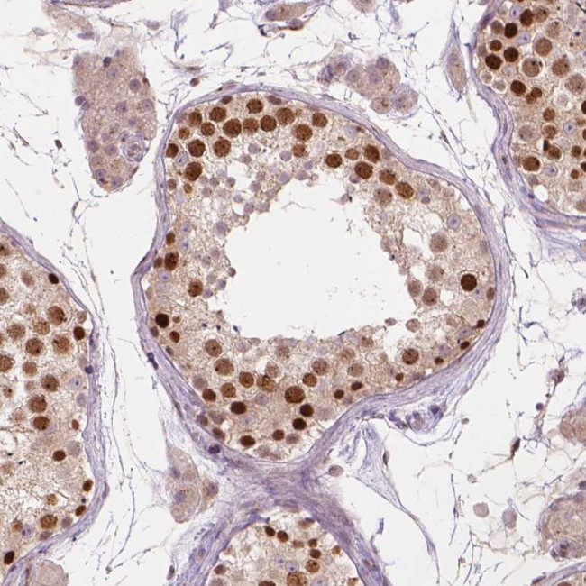 IFFO1 Antibody in Immunohistochemistry (Paraffin) (IHC (P))