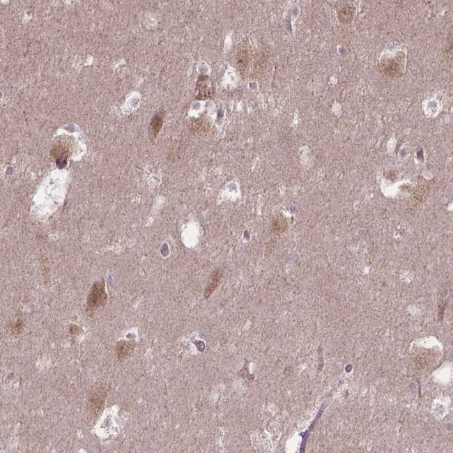 TMEM135 Antibody in Immunohistochemistry (Paraffin) (IHC (P))