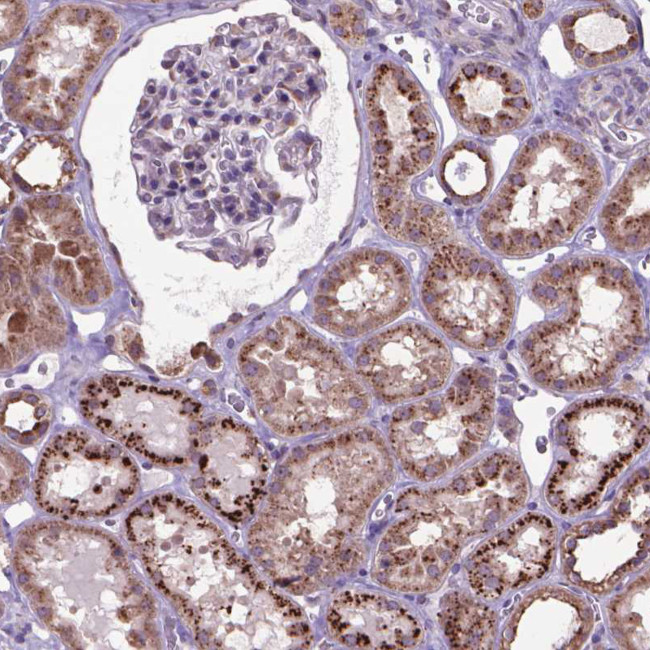 GLB1 Antibody in Immunohistochemistry (Paraffin) (IHC (P))
