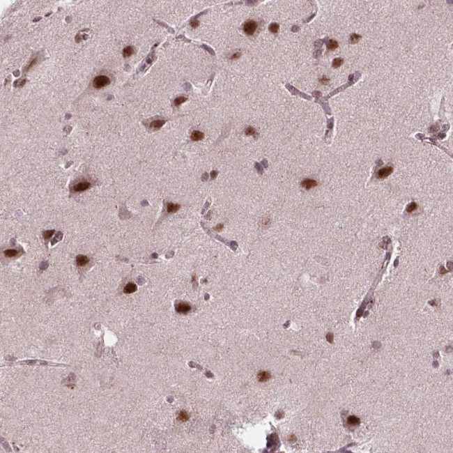 EAF1 Antibody in Immunohistochemistry (Paraffin) (IHC (P))