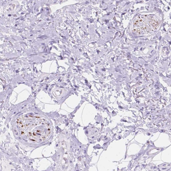 DCC Antibody in Immunohistochemistry (Paraffin) (IHC (P))