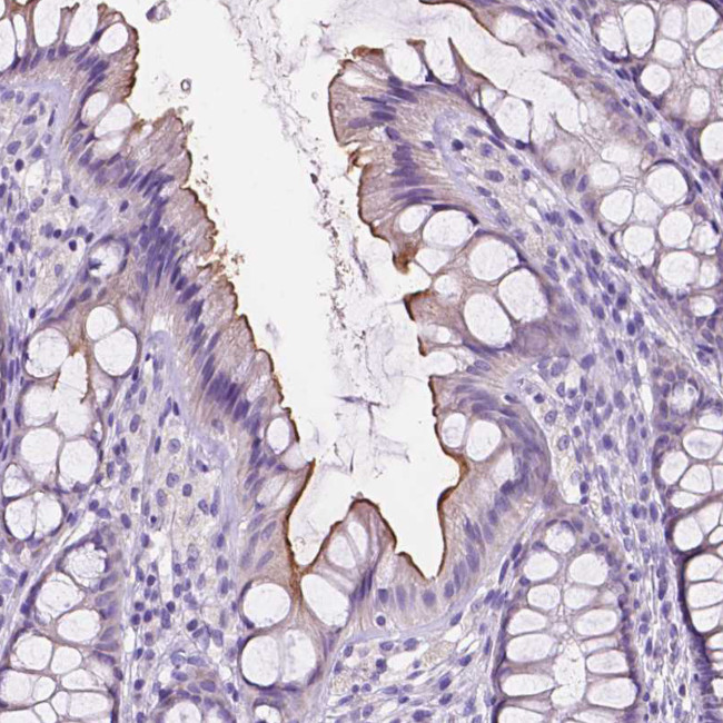 CEACAM7 Antibody in Immunohistochemistry (Paraffin) (IHC (P))