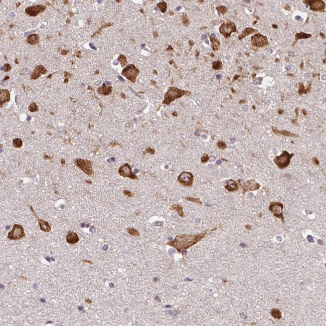 FAM116A Antibody in Immunohistochemistry (Paraffin) (IHC (P))