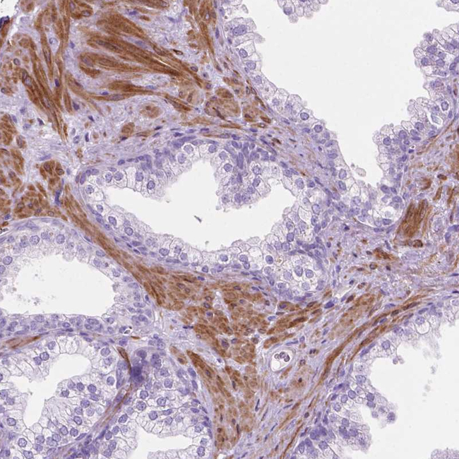 ASPG Antibody in Immunohistochemistry (Paraffin) (IHC (P))
