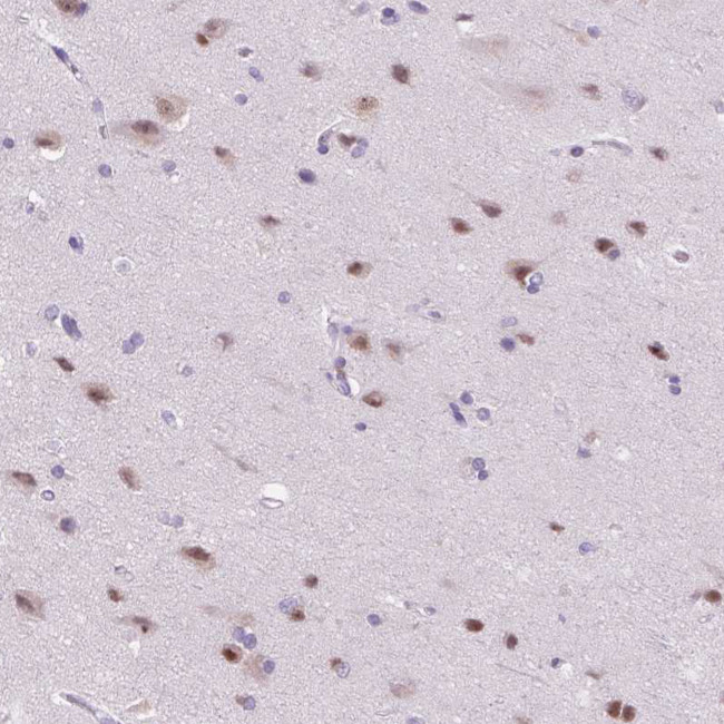 ZMAT4 Antibody in Immunohistochemistry (Paraffin) (IHC (P))