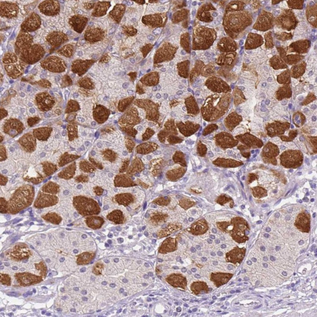 PEX11G Antibody in Immunohistochemistry (Paraffin) (IHC (P))