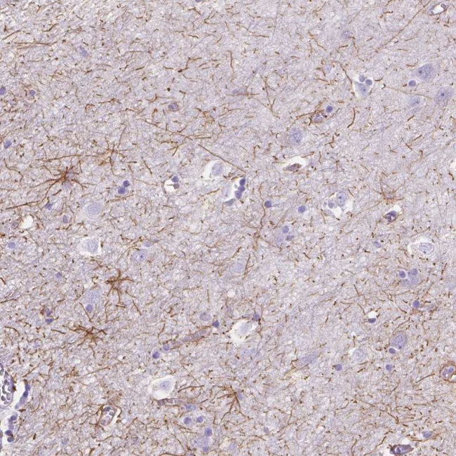 DMWD Antibody in Immunohistochemistry (Paraffin) (IHC (P))