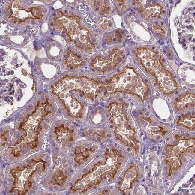 ARL5C Antibody in Immunohistochemistry (Paraffin) (IHC (P))
