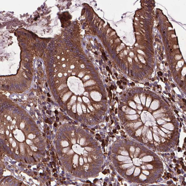 MYH14 Antibody in Immunohistochemistry (Paraffin) (IHC (P))