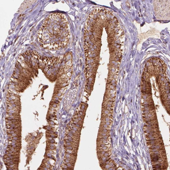 VARS2 Antibody in Immunohistochemistry (Paraffin) (IHC (P))