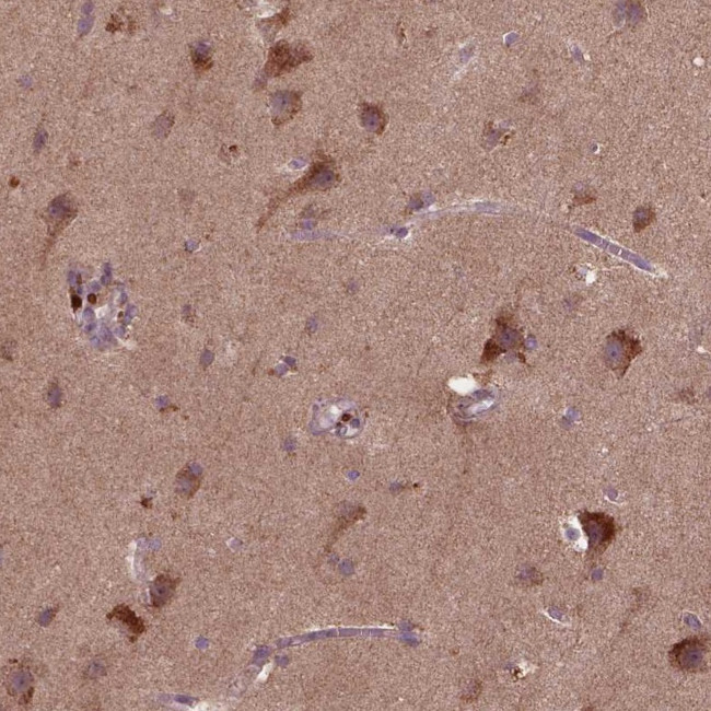 ST6GALNAC5 Antibody in Immunohistochemistry (Paraffin) (IHC (P))