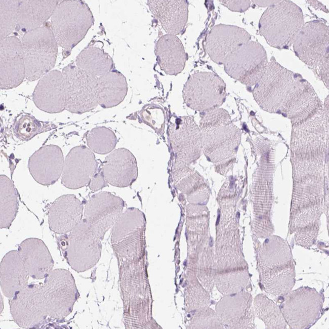 CD84 Antibody in Immunohistochemistry (Paraffin) (IHC (P))