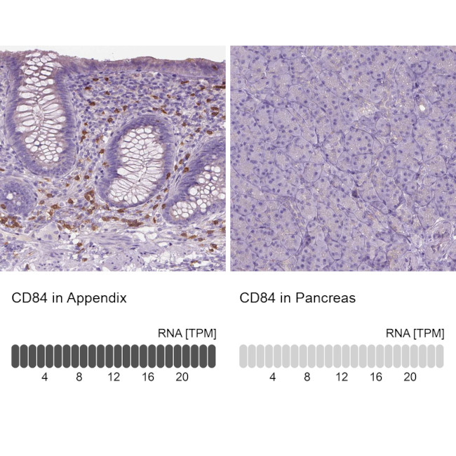 CD84 Antibody in Immunohistochemistry (IHC)