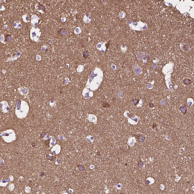 TMEM132E Antibody in Immunohistochemistry (Paraffin) (IHC (P))