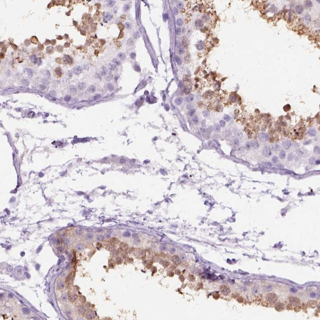 C1orf125 Antibody in Immunohistochemistry (Paraffin) (IHC (P))
