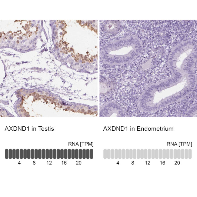 C1orf125 Antibody in Immunohistochemistry (IHC)